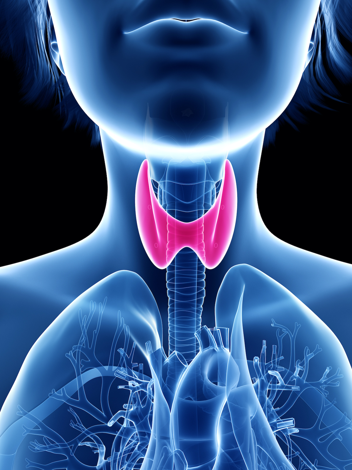 Radiotherapy treatment using Cobalt-60
